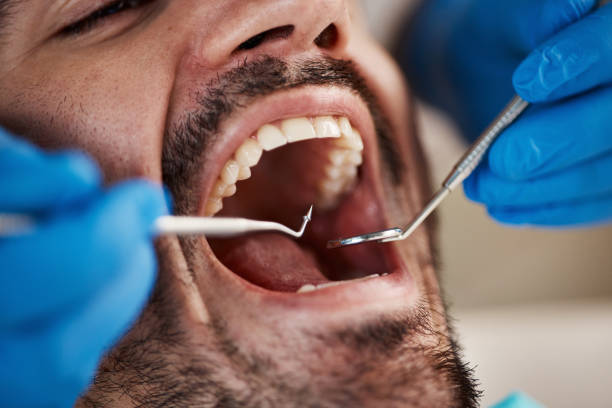 Best Dental X-Rays and Imaging  in Morgantown, IN